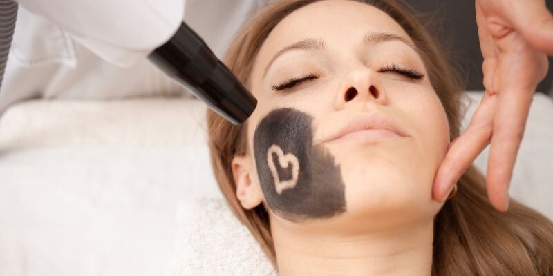 Karbon Peeling ile Cildinizdeki Değişimi Keşfedin