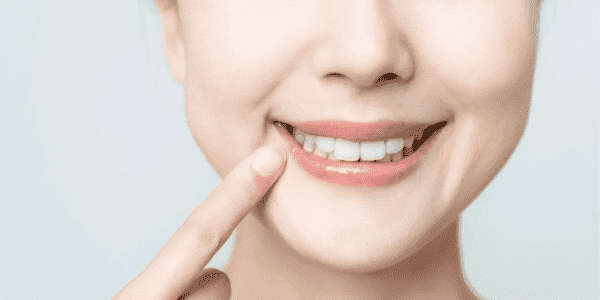 Doğru Protez Diş Bakımı İçin Takip Edilmesi Gereken Adımlar