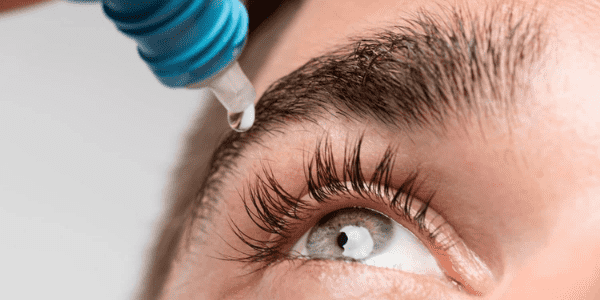 Lens Solüsyonu Bilgi Rehberi