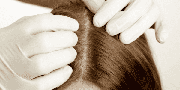 Bitkisel Şampuanlar ile Saç Derisi ve Saç Sağlığının Önemi