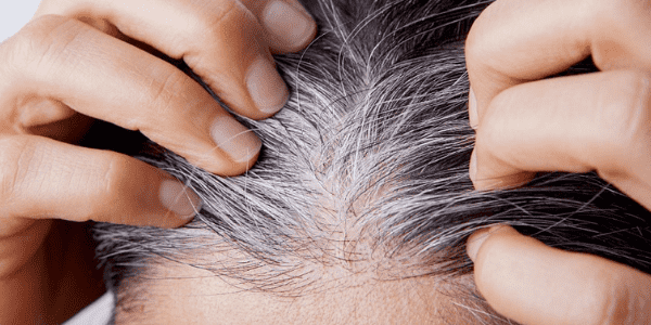 Beyaz Saç Giderici Ürünler ile İstediğiniz Görünümü Elde Etme Rehberi