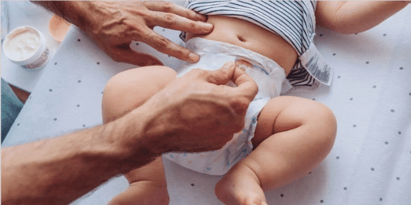 Bebek Pişik Kremleri Tek Çözüm Müdür? Sırasıyla Bebeğin İçin Yapabileceklerin!