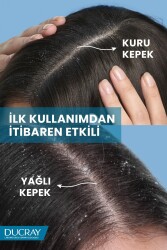 Ducray Kelual Squanorm Kepek Önleyici ve Yatıştırıcı Losyon 200 ml - 4