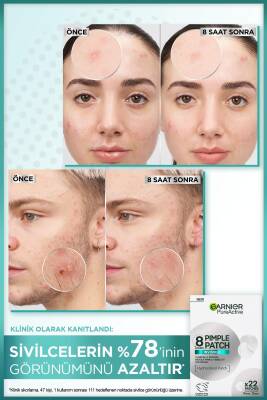 Garnier Pure Active 8 Sivilce Karşıtı Bant 22 Adet - 4